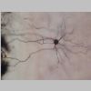 Neuronas Golgi 37.jpg